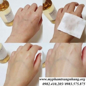nuoc-hoa-hong-skin1004-cap-am