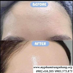 tinh-chat-serum-b5-gc-dung-cho-da-dau