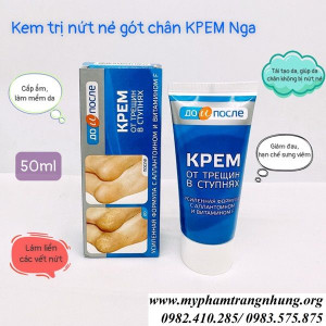 kem-duong-got-chan-kpem-50ml